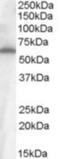 Frizzled-4 antibody, NB100-93397, Novus Biologicals, Western Blot image 