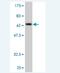 Argonaute RISC Catalytic Component 2 antibody, H00027161-M02, Novus Biologicals, Western Blot image 