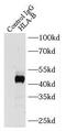 HLA class I histocompatibility antigen, B-51 alpha chain antibody, FNab03897, FineTest, Immunoprecipitation image 