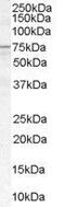 Acyl-CoA Synthetase Long Chain Family Member 5 antibody, GTX89348, GeneTex, Western Blot image 