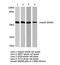 SMAD Family Member 3 antibody, LS-C175902, Lifespan Biosciences, Western Blot image 
