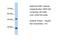 Fructose-Bisphosphatase 1 antibody, PA5-41999, Invitrogen Antibodies, Western Blot image 