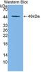 Tryptophan Hydroxylase 2 antibody, LS-C373468, Lifespan Biosciences, Western Blot image 