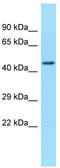 Tubulin Folding Cofactor E Like antibody, TA331364, Origene, Western Blot image 