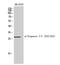 Troponin I3, Cardiac Type antibody, A01720S22S23-1, Boster Biological Technology, Western Blot image 