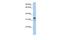 Glycine-N-Acyltransferase Like 2 antibody, GTX46143, GeneTex, Western Blot image 