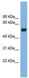 Iroquois Homeobox 2 antibody, TA342272, Origene, Western Blot image 