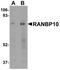 RAN Binding Protein 10 antibody, NBP1-77372, Novus Biologicals, Western Blot image 