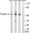 Tubulin Alpha 1a antibody, TA326126, Origene, Western Blot image 