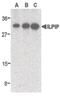 STE20 Related Adaptor Beta antibody, PA5-20036, Invitrogen Antibodies, Western Blot image 