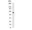 Cytochrome P450 Family 19 Subfamily A Member 1 antibody, R30562, NSJ Bioreagents, Western Blot image 