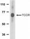 Interleukin-27 receptor subunit alpha antibody, NBP1-76728, Novus Biologicals, Western Blot image 