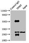 Thiopurine S-Methyltransferase antibody, CSB-PA00585A0Rb, Cusabio, Immunoprecipitation image 