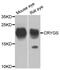 Crystallin Gamma S antibody, PA5-76294, Invitrogen Antibodies, Western Blot image 