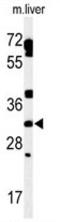 TBC1 Domain Family Member 7 antibody, AP54177PU-N, Origene, Western Blot image 