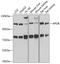 Apolipoprotein B antibody, A00100, Boster Biological Technology, Western Blot image 