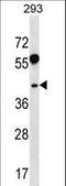 Ras Related GTP Binding B antibody, LS-C158898, Lifespan Biosciences, Western Blot image 