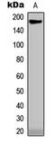 Collagen Type XVIII Alpha 1 Chain antibody, LS-C358951, Lifespan Biosciences, Western Blot image 