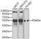 Proteasome 26S Subunit, Non-ATPase 4 antibody, MBS126620, MyBioSource, Western Blot image 