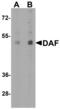 CD55 Molecule (Cromer Blood Group) antibody, LS-C336216, Lifespan Biosciences, Western Blot image 