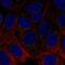 Acetylcholinesterase antibody, NBP2-55516, Novus Biologicals, Immunofluorescence image 