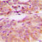 SRC Proto-Oncogene, Non-Receptor Tyrosine Kinase antibody, GTX32265, GeneTex, Immunohistochemistry paraffin image 