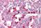 BCL2 Like 14 antibody, orb87295, Biorbyt, Immunohistochemistry paraffin image 