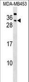 Carcinoembryonic Antigen Related Cell Adhesion Molecule 7 antibody, LS-B13068, Lifespan Biosciences, Western Blot image 