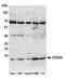 Cytochrome C Oxidase Subunit 5A antibody, A305-577A-M, Bethyl Labs, Western Blot image 