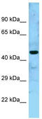 Mitochondrial Ribosome Associated GTPase 2 antibody, TA343249, Origene, Western Blot image 