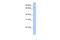 Lipase Maturation Factor 2 antibody, A13780, Boster Biological Technology, Western Blot image 