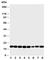 NME/NM23 Nucleoside Diphosphate Kinase 1 antibody, R30927, NSJ Bioreagents, Western Blot image 