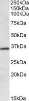 Homeobox A4 antibody, PA5-19309, Invitrogen Antibodies, Western Blot image 