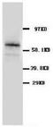 Solute Carrier Family 1 Member 3 antibody, AP23255PU-N, Origene, Western Blot image 