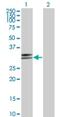 Major Histocompatibility Complex, Class II, DP Alpha 1 antibody, H00003113-M03, Novus Biologicals, Western Blot image 