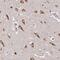 ATP Binding Cassette Subfamily A Member 2 antibody, NBP2-14249, Novus Biologicals, Immunohistochemistry frozen image 