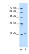 TCAP antibody, NBP1-56626, Novus Biologicals, Western Blot image 