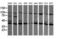 Mitogen-Activated Protein Kinase Kinase 1 antibody, LS-C174487, Lifespan Biosciences, Western Blot image 