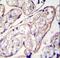 Pyrroline-5-Carboxylate Reductase 2 antibody, LS-C162338, Lifespan Biosciences, Immunohistochemistry paraffin image 