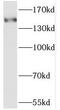 Sterile Alpha Motif Domain Containing 9 antibody, FNab07590, FineTest, Western Blot image 