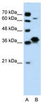 FOS Like 1, AP-1 Transcription Factor Subunit antibody, TA329252, Origene, Western Blot image 