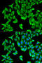 Proteasome 26S Subunit, Non-ATPase 9 antibody, A06113, Boster Biological Technology, Western Blot image 