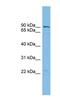 TBC1 Domain Family Member 16 antibody, NBP1-57666, Novus Biologicals, Western Blot image 