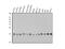 Fission, Mitochondrial 1 antibody, A01932-2, Boster Biological Technology, Western Blot image 