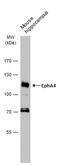 EPH Receptor A4 antibody, GTX104109, GeneTex, Western Blot image 