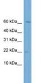 Prefoldin Subunit 2 antibody, NBP1-79641, Novus Biologicals, Western Blot image 