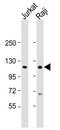 Nuclear Receptor Binding SET Domain Protein 2 antibody, MBS9201595, MyBioSource, Western Blot image 