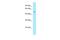 Syntrophin Beta 2 antibody, A08130, Boster Biological Technology, Western Blot image 