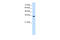 Transient receptor potential cation channel subfamily M member 5 antibody, 28-258, ProSci, Western Blot image 