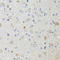 Beta-2-Microglobulin antibody, LS-C747512, Lifespan Biosciences, Immunohistochemistry paraffin image 